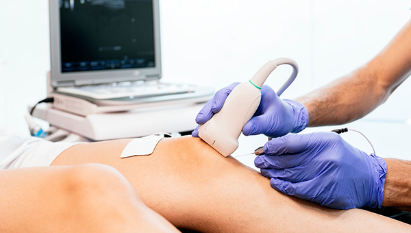 Τενόντια Ηλεκτρόλυση