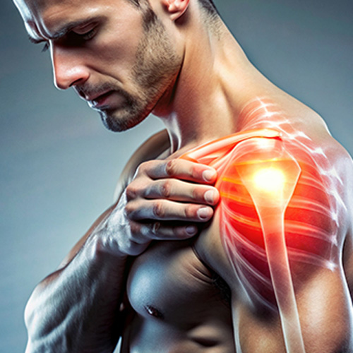 Ασβεστοποιός Τενοντίτιδα Ώμου