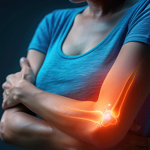 Επικονδυλίτιδα